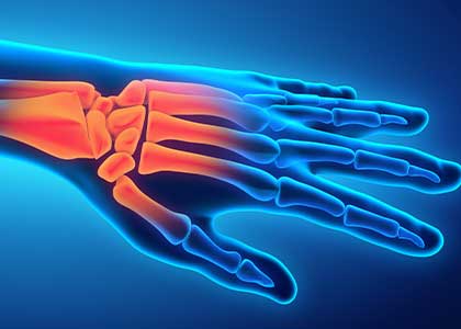 Hand Injuries