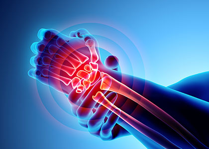 Radial Sided Wrist Injuries